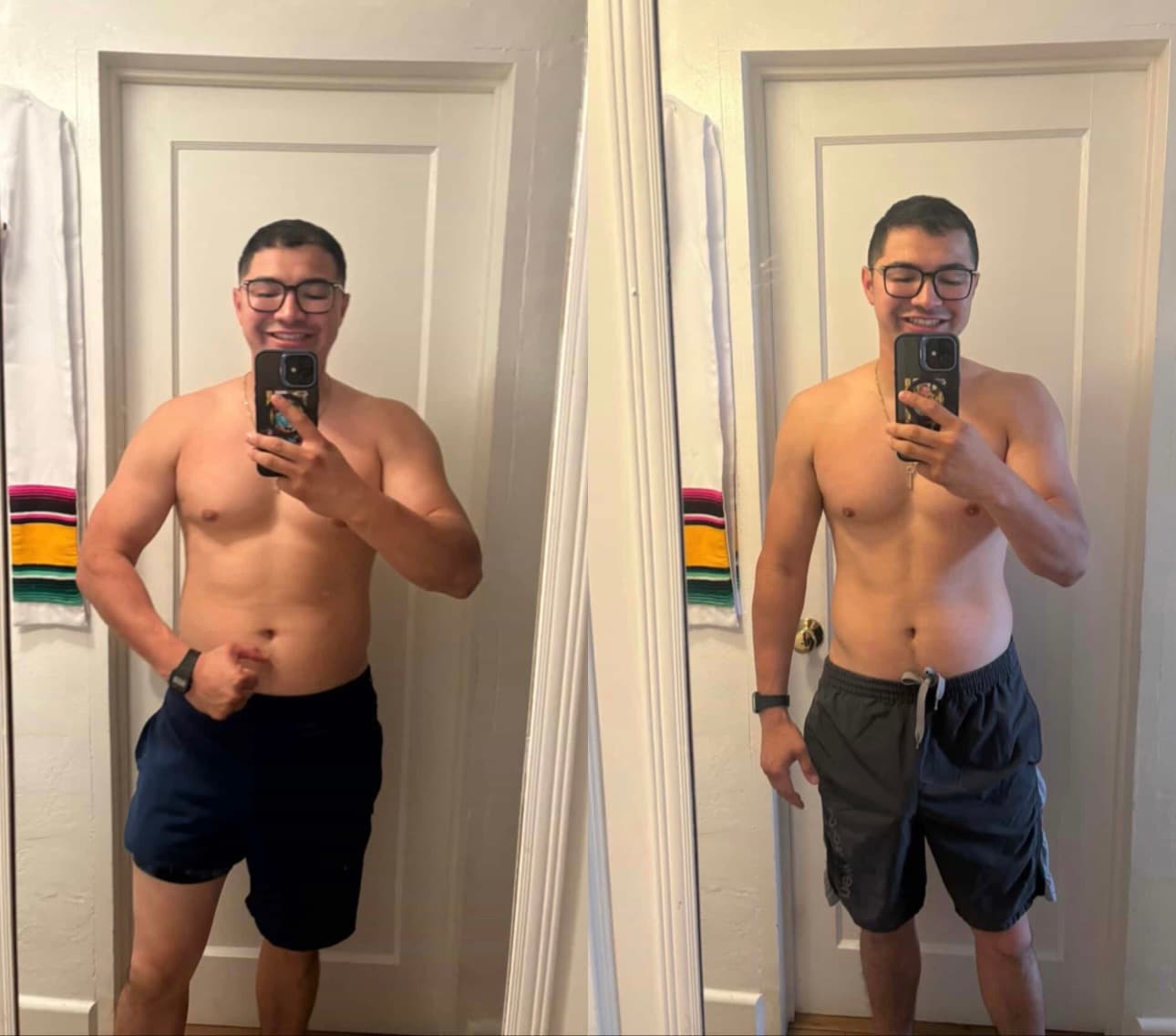 Robert before and after
